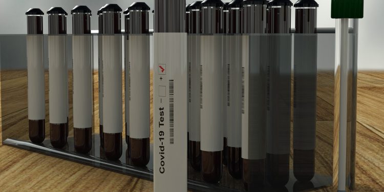 NRI moves court seeking intervention from Centre to regulate Covid-19 tests conducted at Indian airports