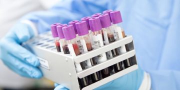 27-Year Sentence for Indian-Origin Man in $463M Medicare Fraud Scheme