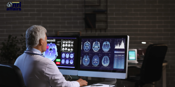 Investigating-Breakthroughs-in-Dementia Diagnosis-Indian-Origin-Neurologist-nriaffairs