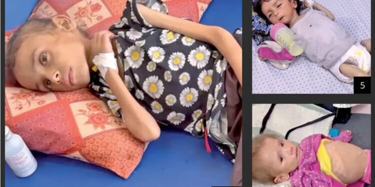 Only Liars And Manipulators Say Gaza Isn't Starving 1 Only Liars And Manipulators Say Gaza Isn’t Starving